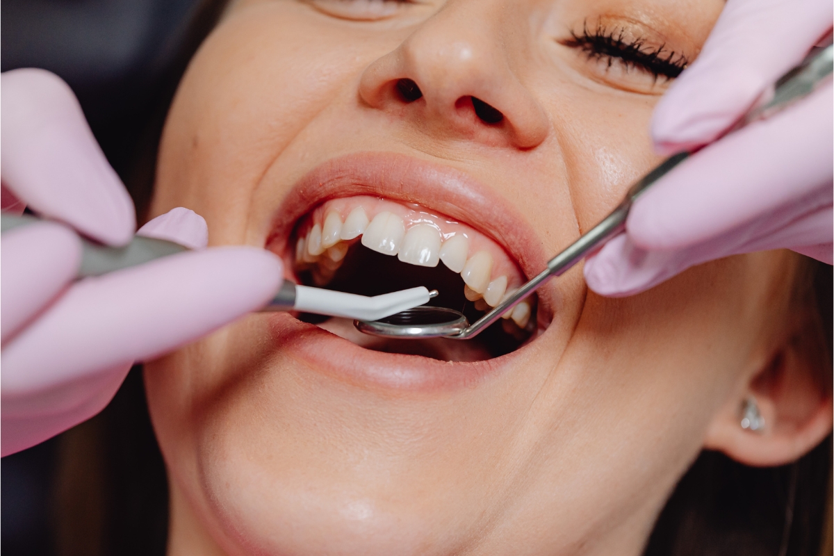 tooth extraction in Rockaway