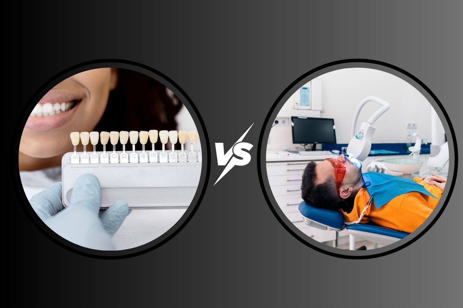 veneers vs teeth whitening