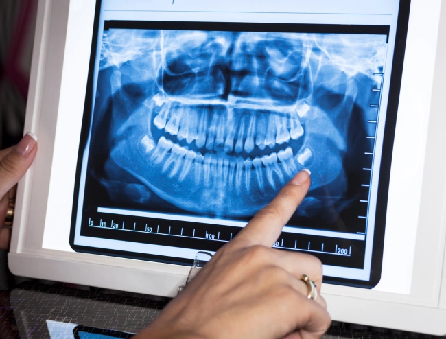 dental x-rays and imaging in rockaway