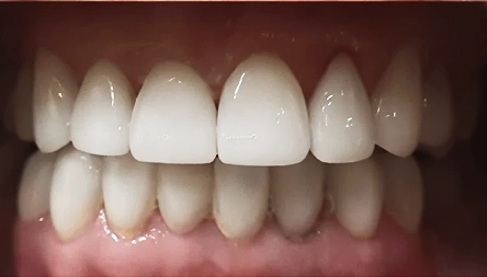 General Dentistry in Rockaway